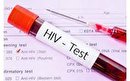 آزمایش رایگان اج آی وی به مناسبت روز جهانی ایدز