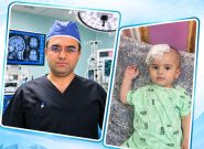 انجام موفقیت آمیز عمل جراحی شانت گذاری مغزی برای کودک دو ساله در بیمارستان دهدشت انجام موفقیت آمیز عمل جراحی شانت گذاری مغزی برای کودک دو ساله در بیمارستان دهدشت